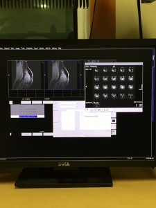 2015-02-01- Computer Screen- UCB