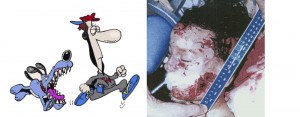 Breed Specific Legislation- Cartoon and Injured Child