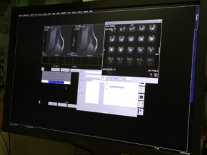 canine fMRI research- Localizer and functional images of Kalita, a dog scanned during our January visit to UC Berkeley.